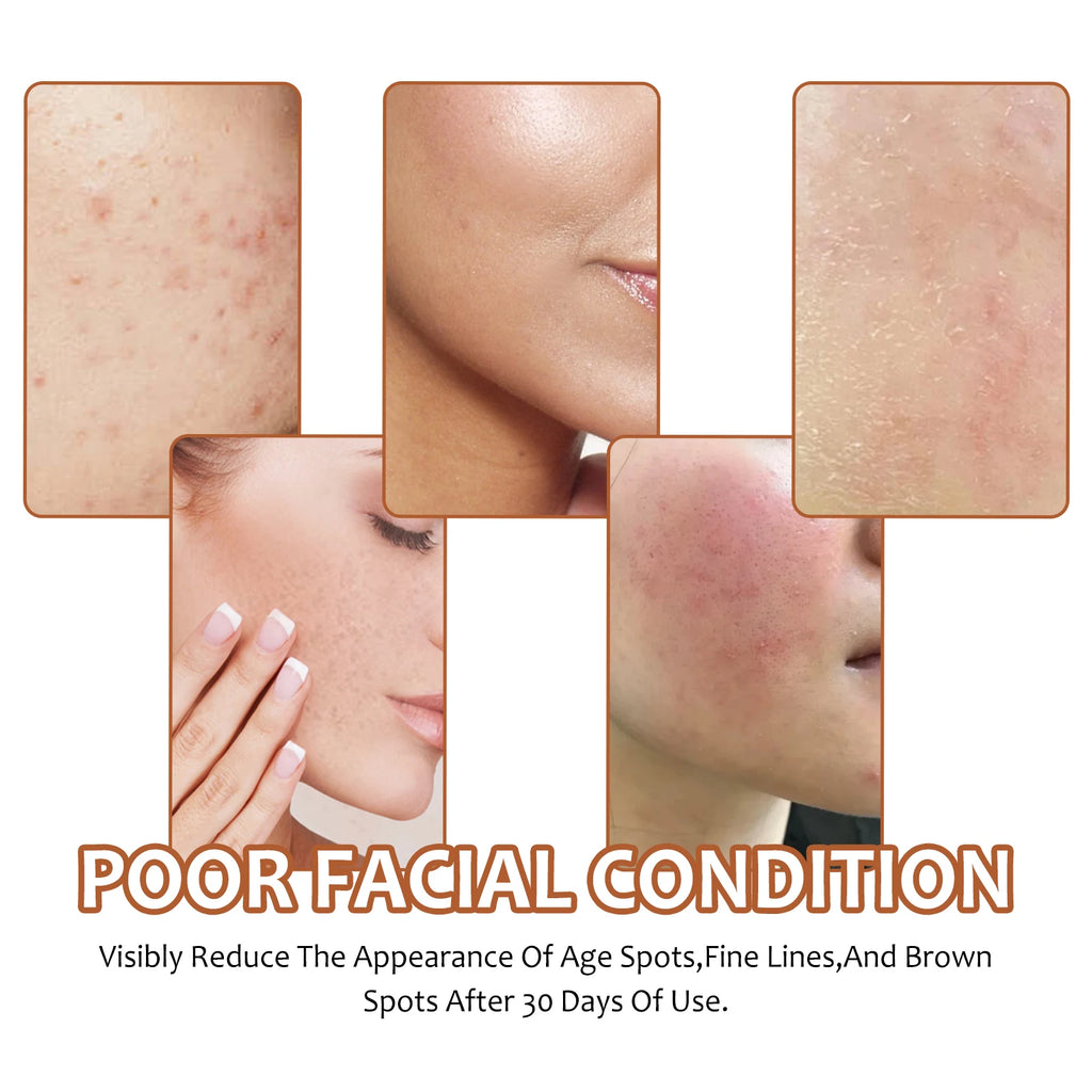 Lemon Turmeric Kojic Acid Soap Brightening Deeply Cleansing Glowing Body Rejuvenating Exfoliating Even Skin Tone Handmade Soap