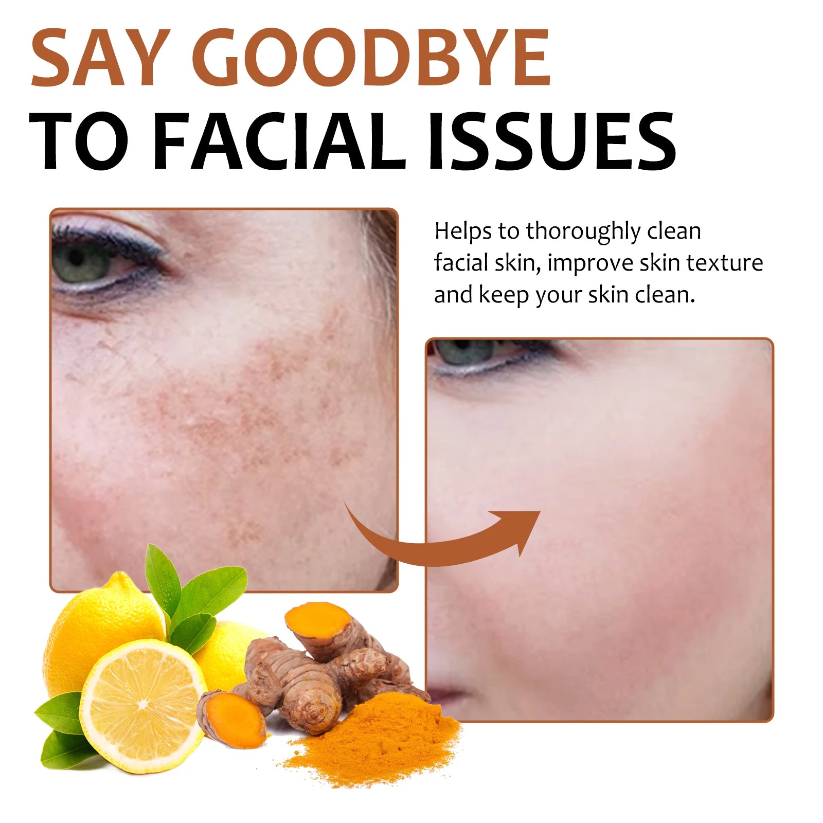 Lemon Turmeric Kojic Acid Soap Brightening Deeply Cleansing Glowing Body Rejuvenating Exfoliating Even Skin Tone Handmade Soap